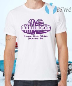Vitiligo love the skin you’re in T-Shirts