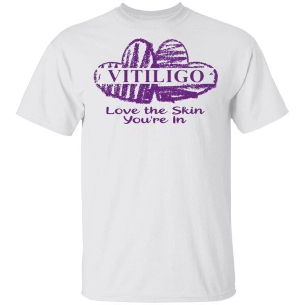Vitiligo love the skin you’re in T-Shirt